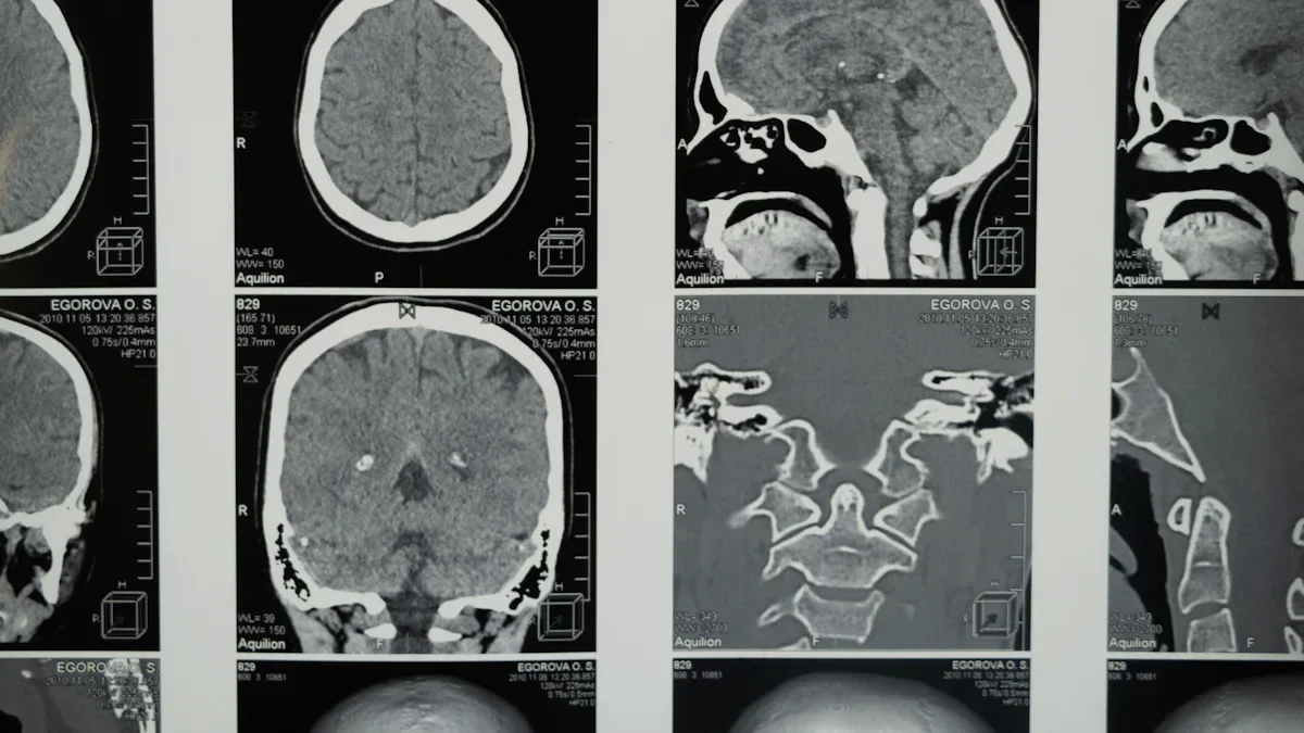 Gewitter im Kopf – Projekt und Wirkung